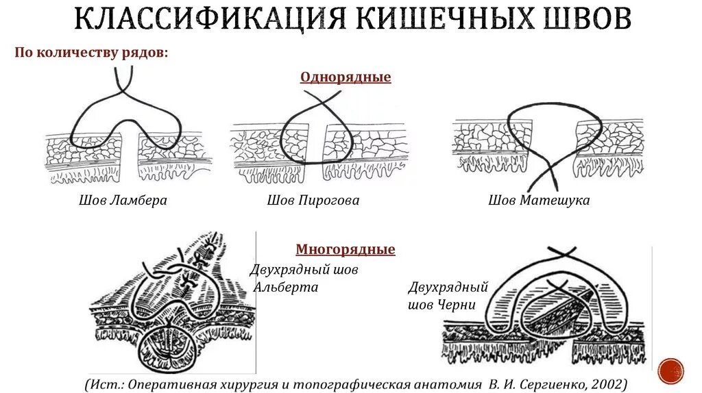 Виды кишечных