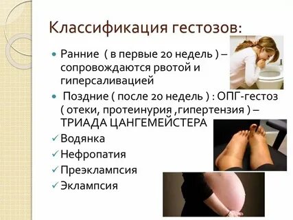 Отек при беременности на поздних сроках