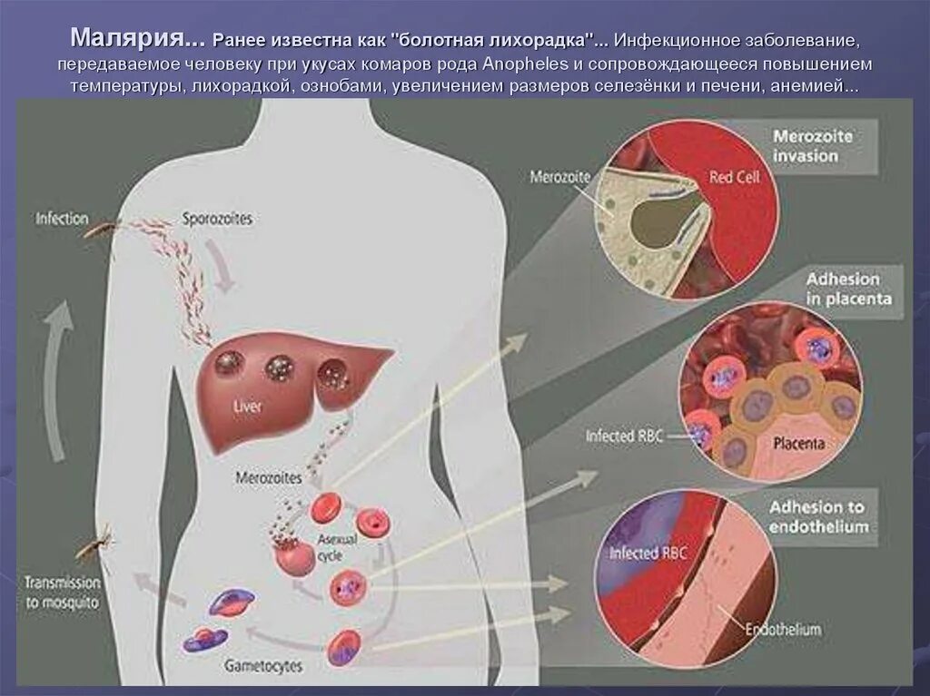 Тяжелое течение малярии ассоциируется чаще с возбудителем. Малярия Болотная лихорадка. Инфекционные заболевания малярия. Малярия заболевание человека.