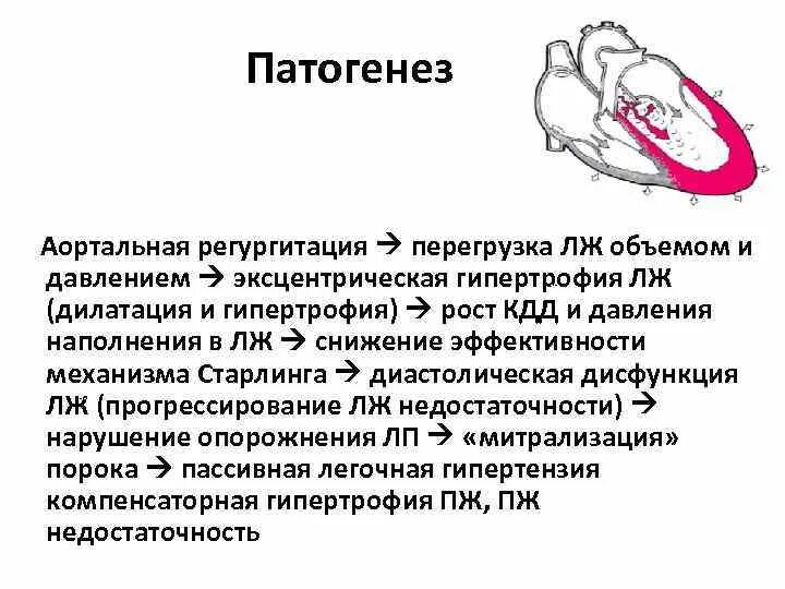 Аортальная гипертрофия. Причины развития гипертрофии левого желудочка. Недостаточность аортального клапана гипертрофия. Аортальная гипертрофия. Перегрузка сердца объемом и давлением.