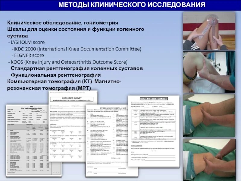 При определении функции подвижности коленного сустава