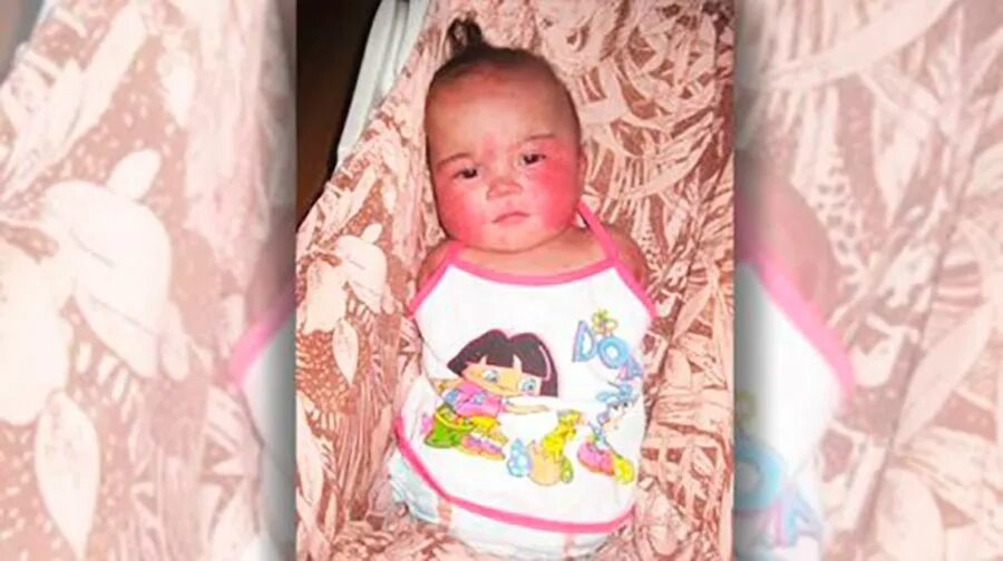 перуанка йована йумбо руис. эрика тамбурини без рук и ног. ребенок родился без рук и ног. ник вуйчич маленький. дети рожденные без рук.