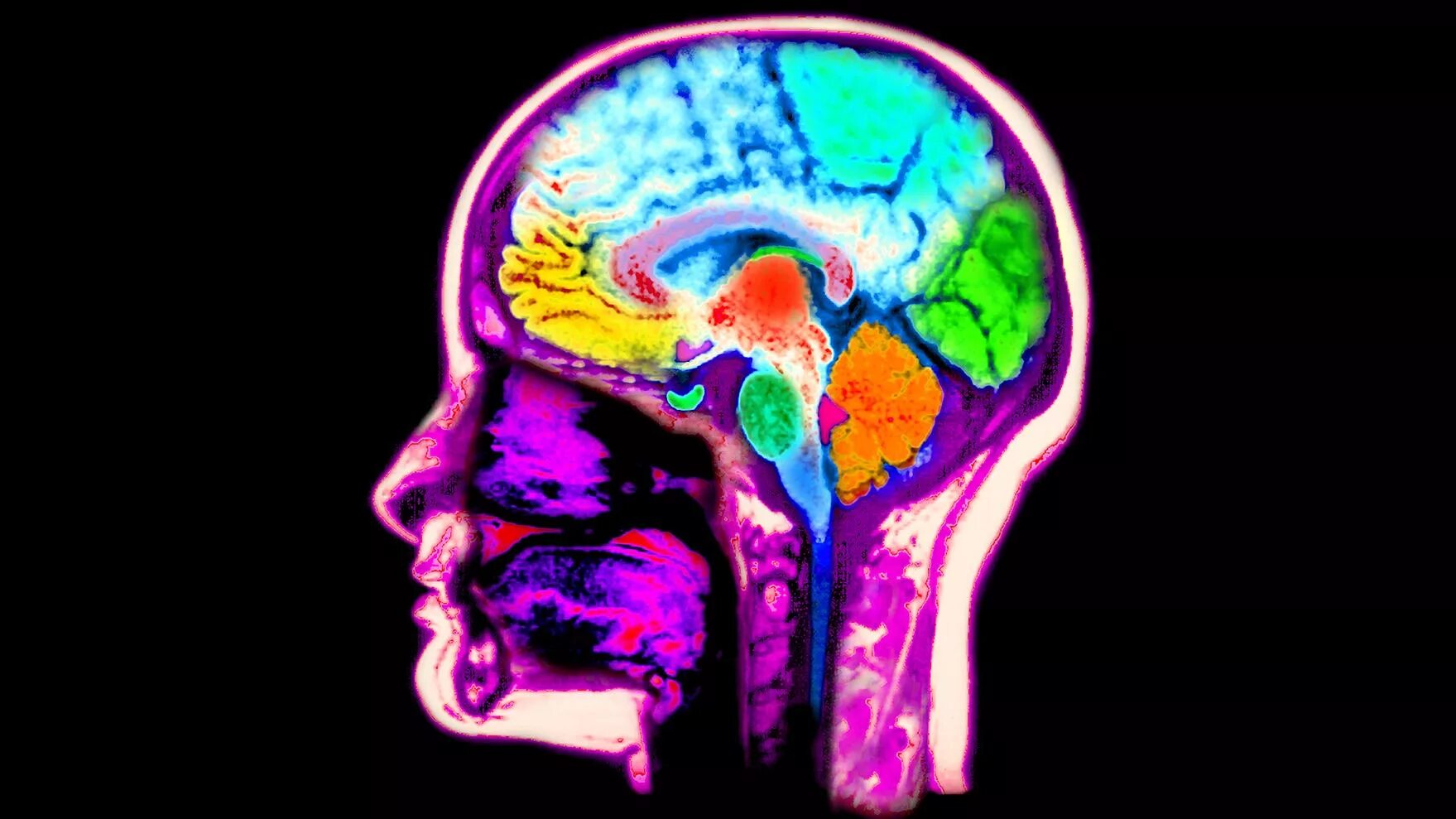 Dom!no обложка. Sensory memory. Acid brain. Мозг под лсд и без. Hotspot acid hard.