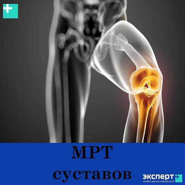 Мрт суставов пермь. Мрт суставов пермь