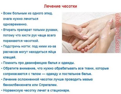 День зуда