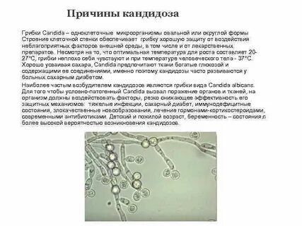 Молочница у мужчин причины возникновения