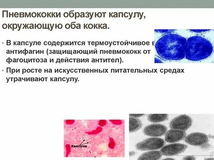 Палочка пневмококка