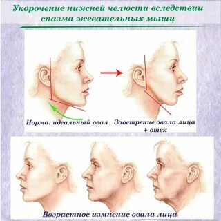 Линия челюсти