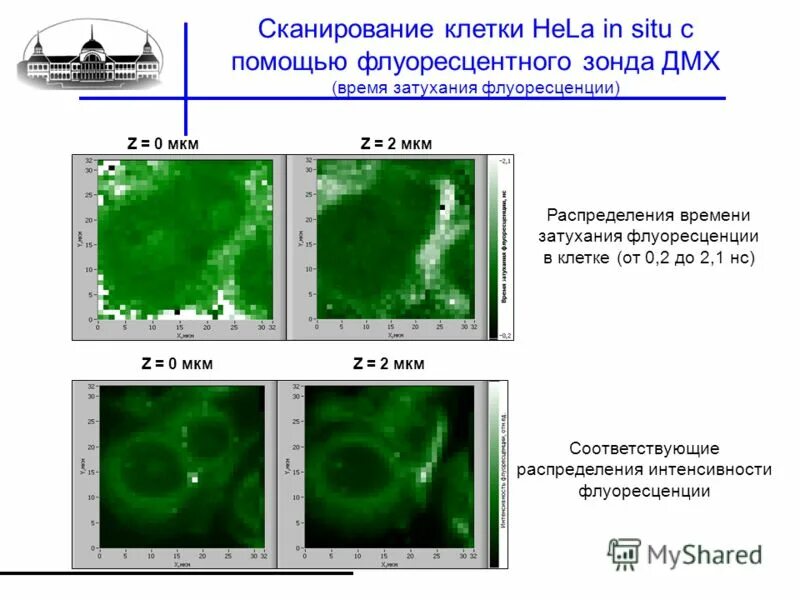 позитронно-эмиссионная томография метастазы. офэкт кт сканер. молекула под микроскопом. лазерная конфокальная микроскопия. пэт кт томограмма.