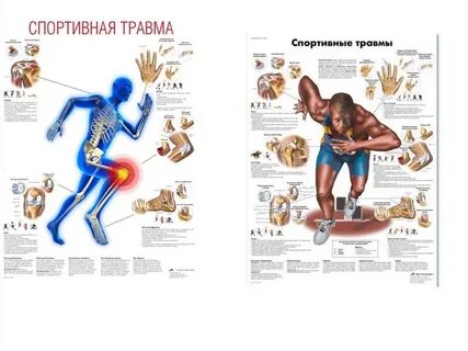 Какие есть спортивные травмы