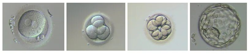 Эмбрион после пересадки. Культивирование эмбрионов эко. Эко под микроскопом оплодотворение яйцеклетки. Бластоциста 2бб. Трансплантация эмбрионов.
