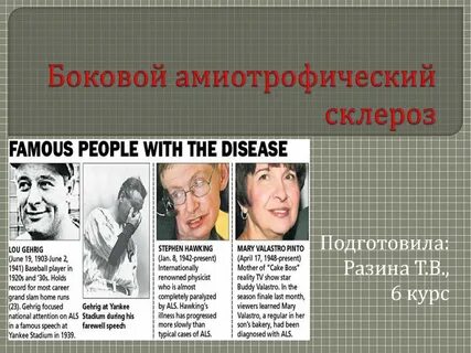 Боковой амиотрофический склероз клинические рекомендации