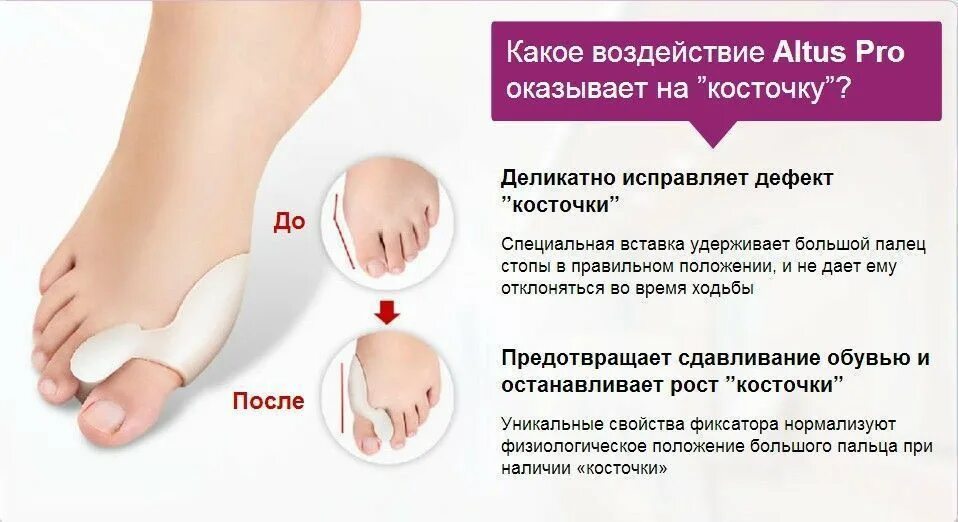 Вальгус какую обувь. Фиксатор "valgus Pro" (вальгус про). Корректор для большого пальца valgus Pro (вальгус про). Фиксатор от косточки. Фиксатор для косточки на ноге.