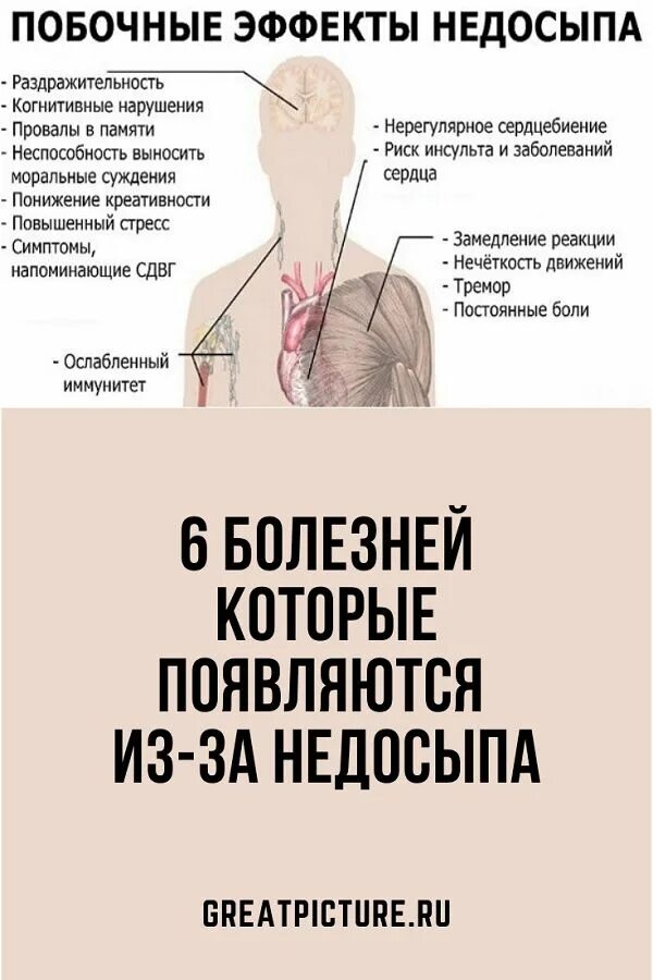 Умирали ли от недосыпа. Болезни из за недосыпа. Заболевания от недостатка сна. Болезни из за недостатка сна. Недосып и сердце.