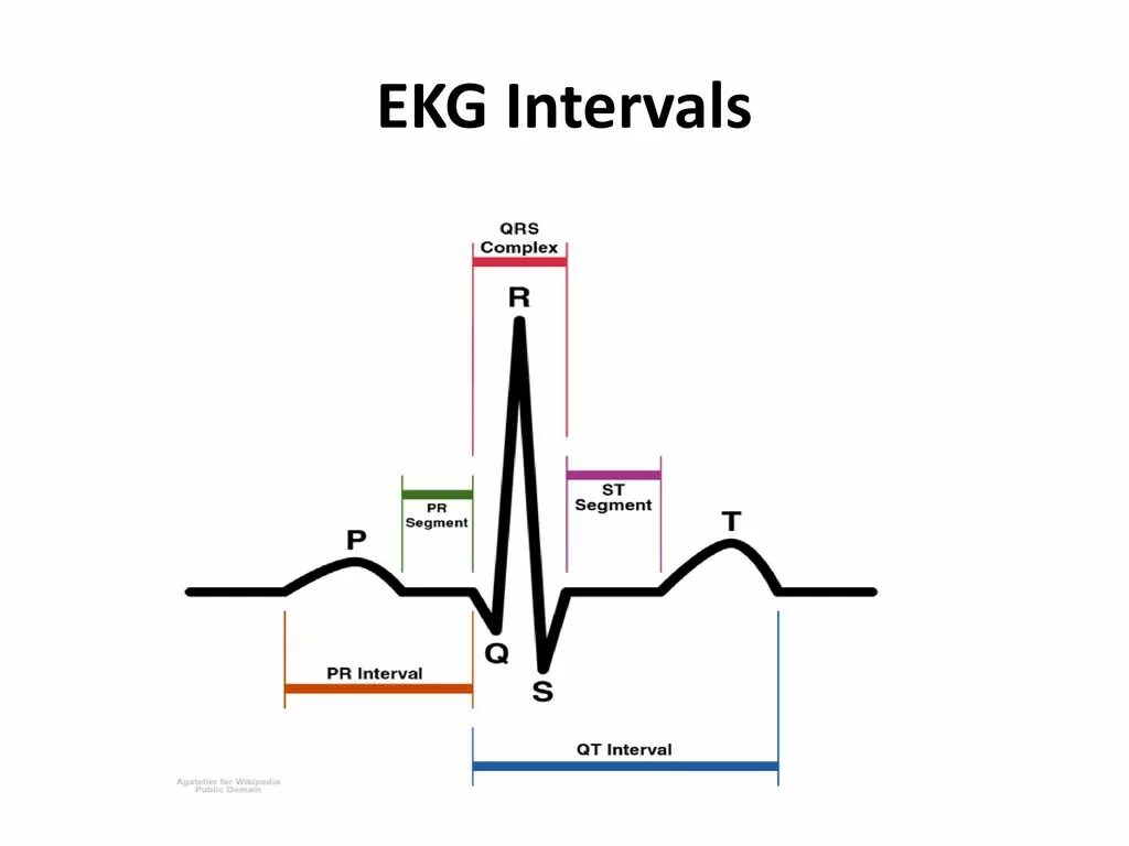 Интервал p p на экг. Комплекс qrs на экг. комплекс qrs на экг норма. расшифровка экг qrs. формы комплекса qrs на экг.