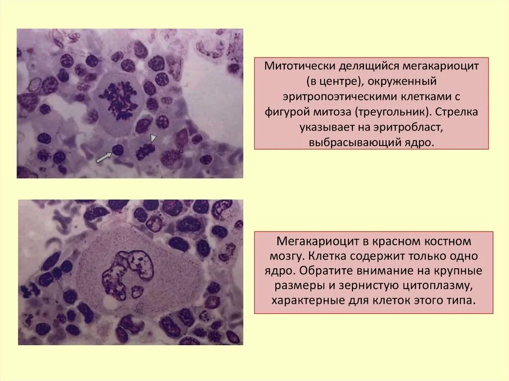 Мегакариоцит гистология. Мегакариоциты в костном мозге гистология. Мегакариоциты в костном мозге гистология. Мегакариоцит гистология. Мегакариоциты красного мозга.