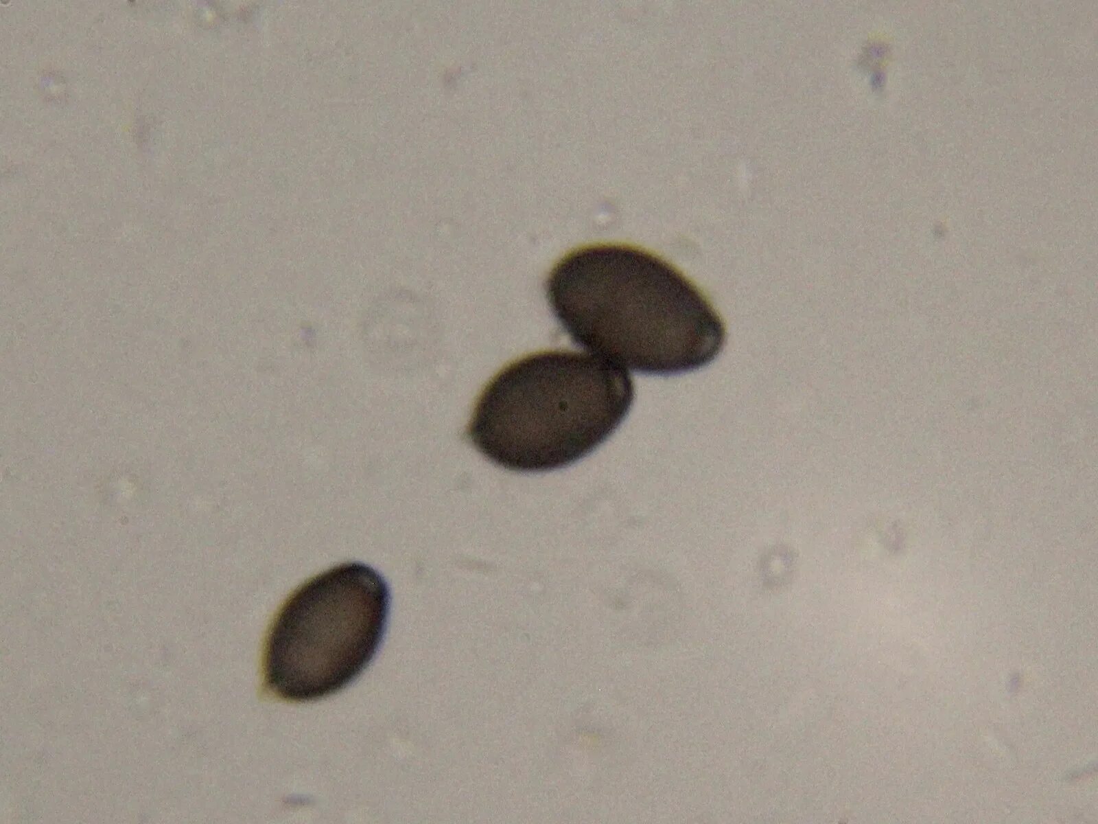 Споры грибов семена. Яйца глистов черные зернышки. Споры Coprinus comatus.. Коричневые яйца гельминтов. Яйца паразитов похожие на семена кунжута.