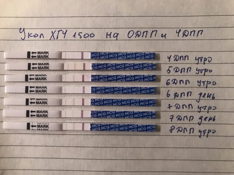 Беременность после укола хгч. ХГЧ после укола ХГЧ 1500. Тест на беременность после укола ХГЧ 1500. Тест на беременность после укола ХГЧ. Тесты после укола Овитрель.