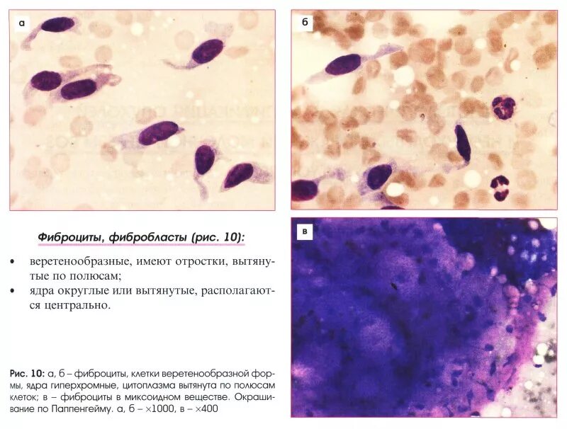 Фибробласты в культуре эмбриональной ткани человека. Фиброциты гистология. Фибробласты и фиброциты препарат гистология. Фибробласты и фиброциты. Клетки соединительной ткани фибробласты.