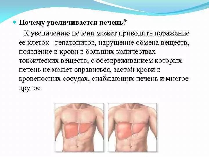 Повышенная печень что означает. Увеличение печени симптомы. Увеличенная печень причины.