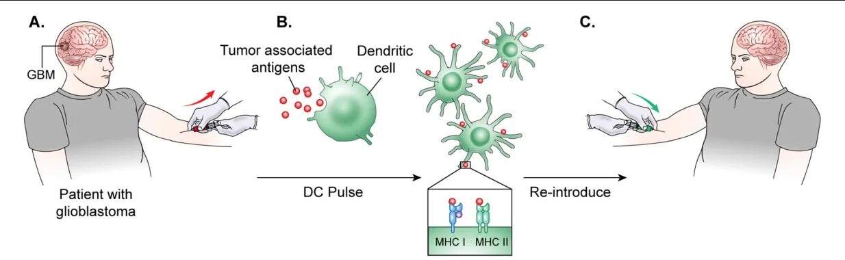 Вакцина дендритными клетками. Вакцины на основе дендритных клеток. Дендритные клетки иммунология. Дендритные клетки иммунология онкология.