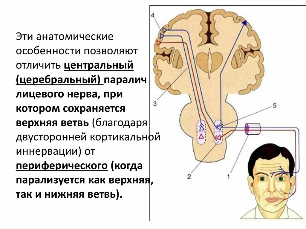 Дифференциальная диагностика периферического пареза лицевого нерва. Дифференциальный диагноз периферический парез лицевого нерва. Синдромы периферического и центрального параличей лицевого нерва. Клиника центрального и периферического паралича лицевого нерва.