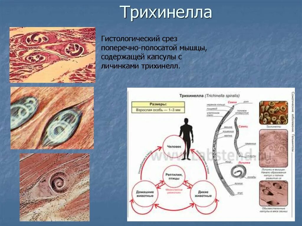 Личинки трихинеллы. Строение личинки трихинеллы. Капсулы личинки трихинеллы строение. Строение личинки трихинеллы свиньи.