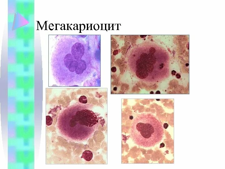 Тромбастения бернара-сулье. Тромбоциты мегакариоциты. Ядра мегакариоцитов. Мегакариоциты в костном мозге гистология. Мегакариоциты красного мозга.