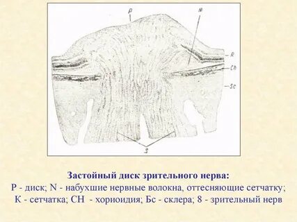 Диск нерв