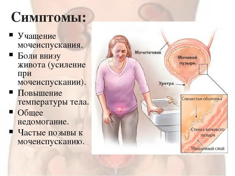 Почему больно во время. Бели при мочеиспусканит. При мочеиспускании болит низ живота. Цистит у женщин симптомы. При частом мочеиспускании у женщин.