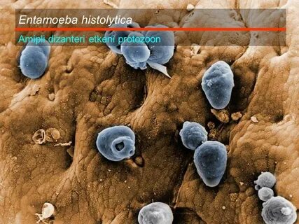Entamoeba histolytica