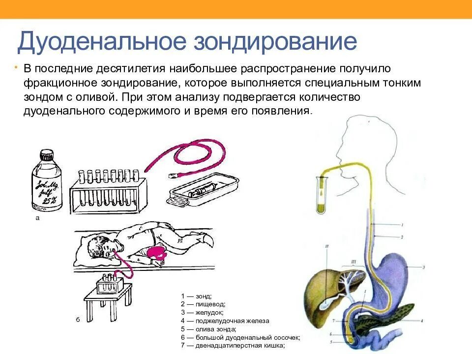 Зонд для проведения дуоденального зондирования. Дуоденальное зондирование желудка. Зонд для исследования дуоденального содержимого. Дуоденальное зондирование тюбаж.