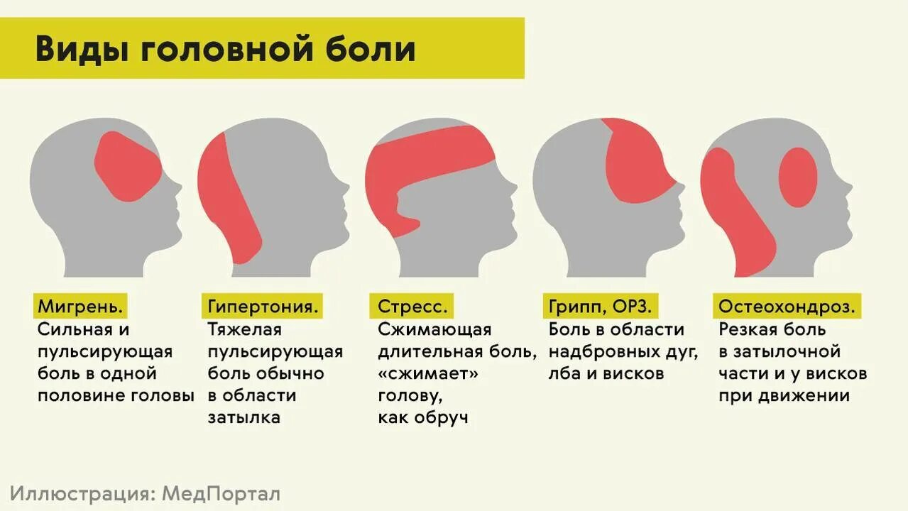 Голова болит сзади затылка. Причина головной боли сзади головы. Болит голова сзади пульсирует почему. Боль при нажатии на голову сзади