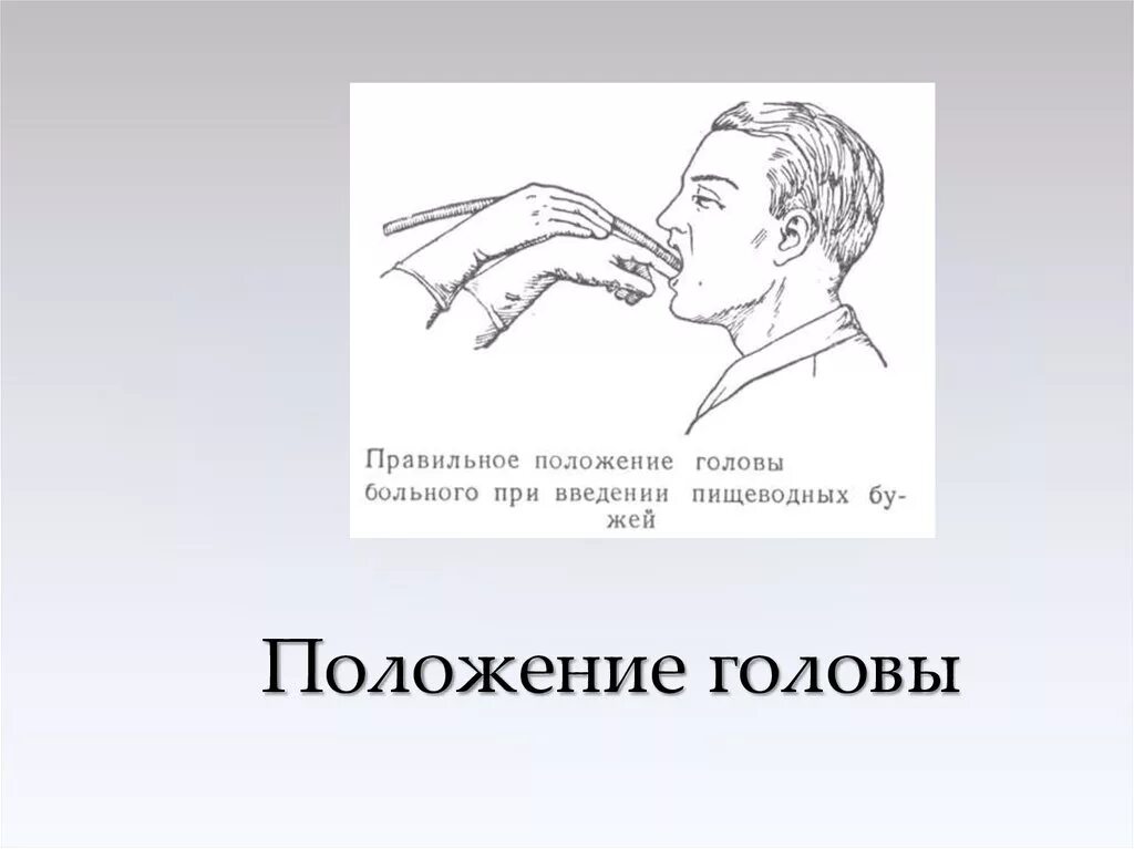 Изменение положения головы. Положение головы. неправильное положение головы. виды положения головы. положение головы нулевая позиция это.