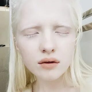Элден ринг альбиносы