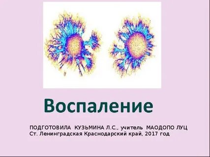 Воспаление