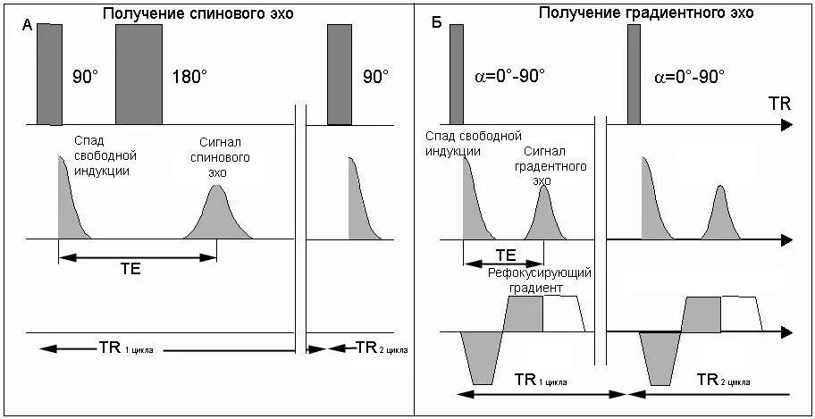 Эхо гостомеля. Импульсные последовательности в мрт. Последовательность градиентного Эха. Градиентное Эхо в мрт это. Последовательность импульсов градиентное Эхо.