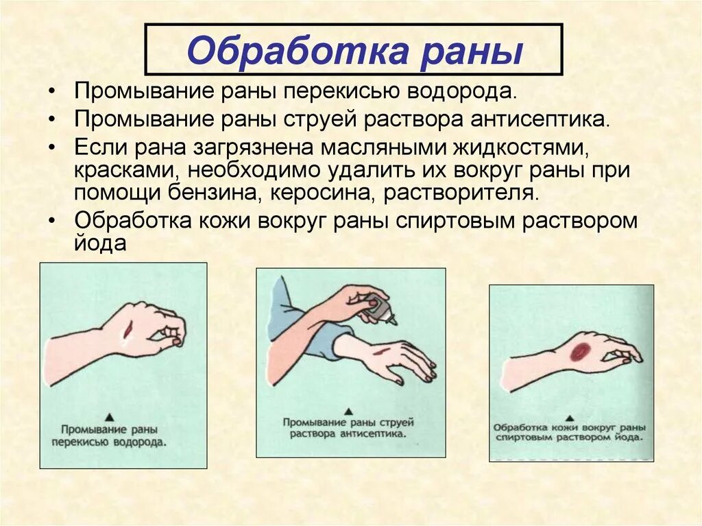 Сильная рана что делать. При обработке глубокой раны необходимо. Как правильно обработать рану. Правильная обработка открытой раны.