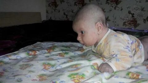 Голова заваливается на бок
