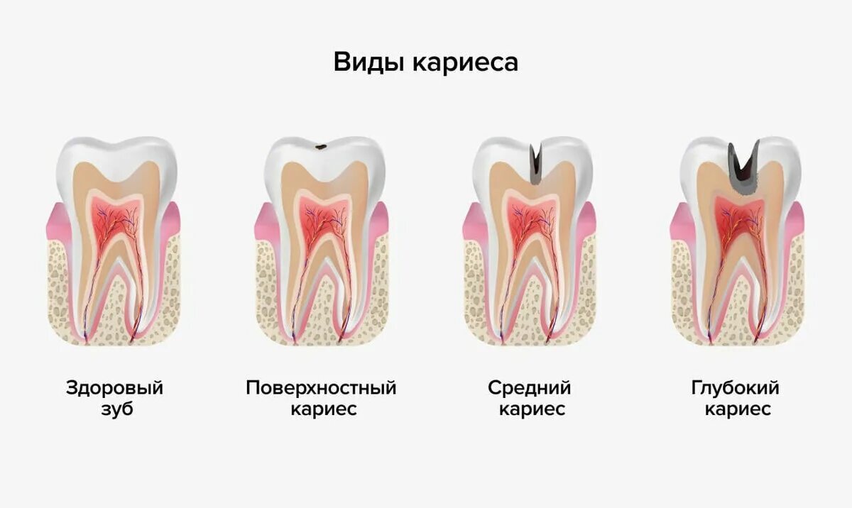 Какие зубы можно лечить