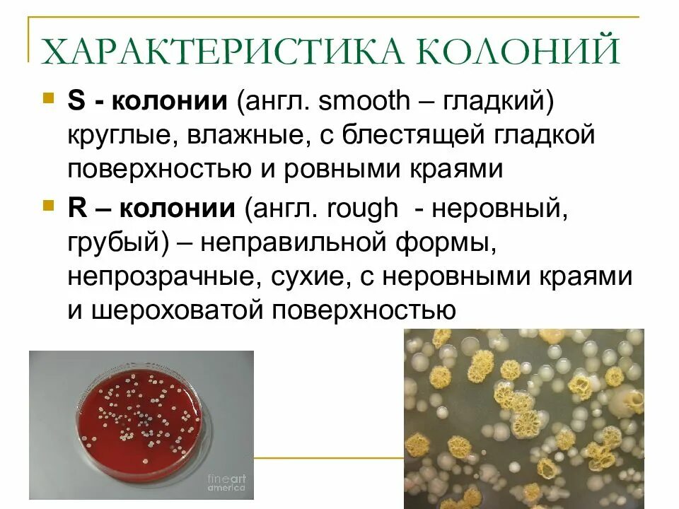 Какие виды колоний существуют. R s колонии бактерий. s и r колонии микробиология. r и s формы колоний бактерий. характеристики микробной колонии.