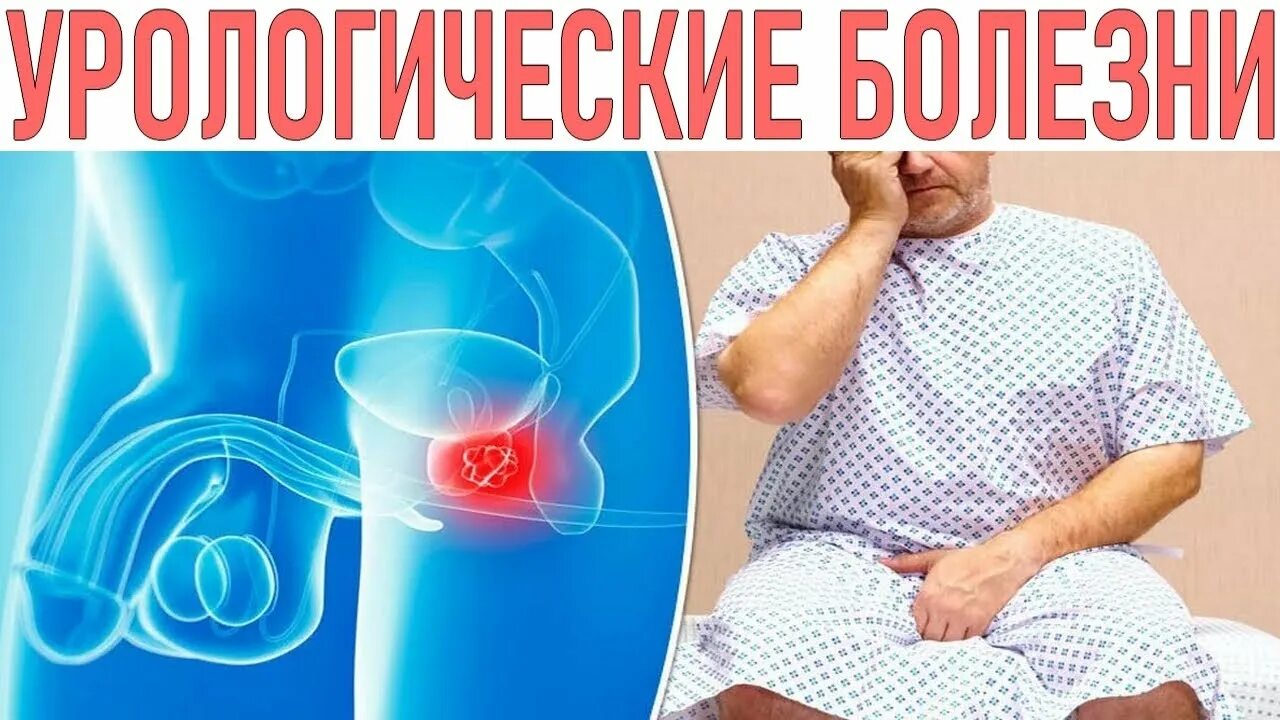 Семиотика урологических заболеваний. Неспецифические воспалительные заболевания в урологии. Урологические заболевания у мужчин лечение. Симптоматология урологических заболеваний. Урологические заболевания у мужчин лечение.