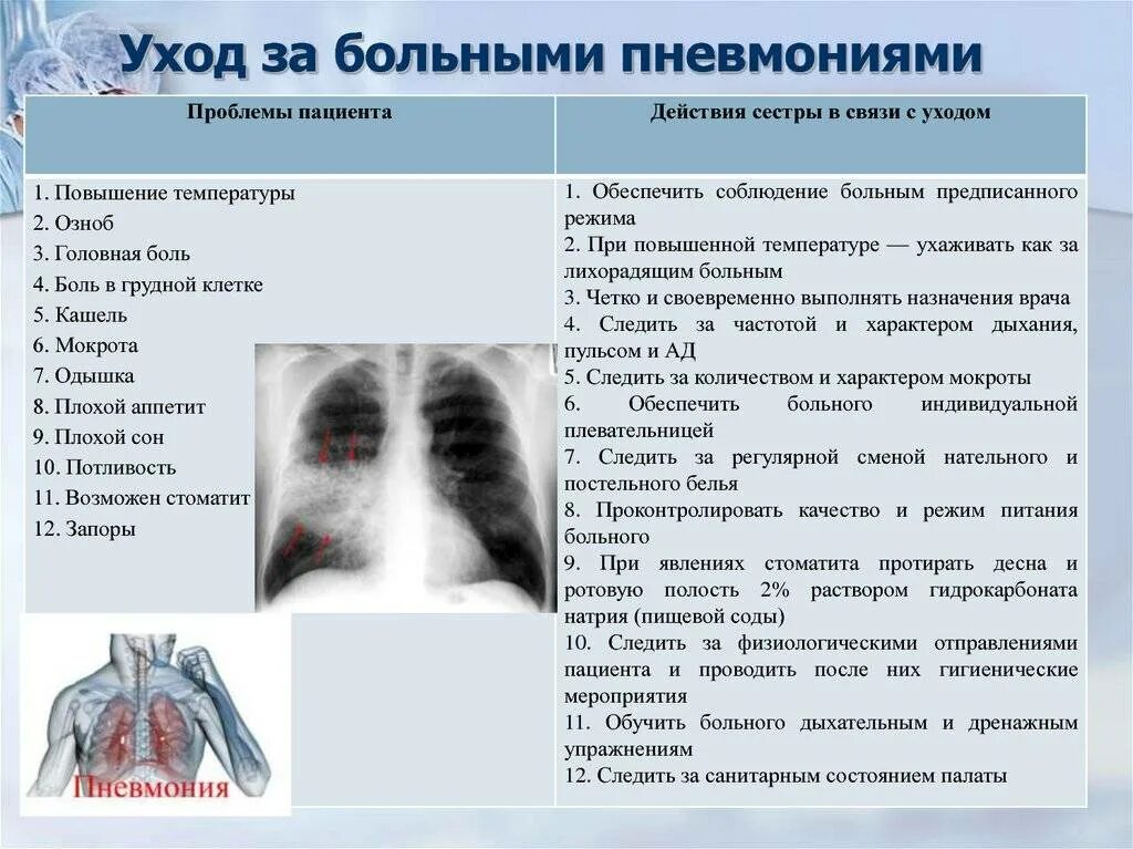 Острая очаговая пневмония симптомы. Начальные симптомы пневмонии. Признаки больных легких