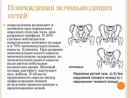 Травмы мочеполовой системы