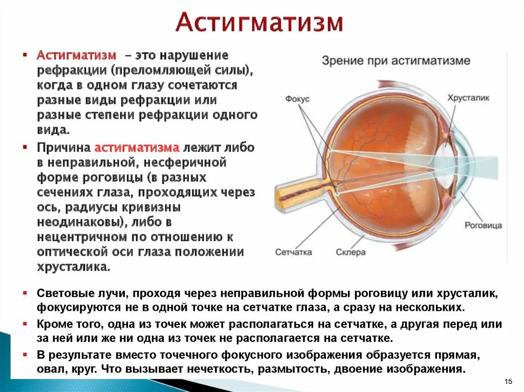 Глаз видит на 3
