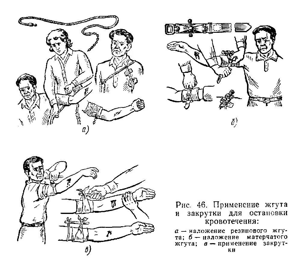 Закрутка при кровотечении