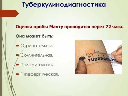 Диаскин тест сдать