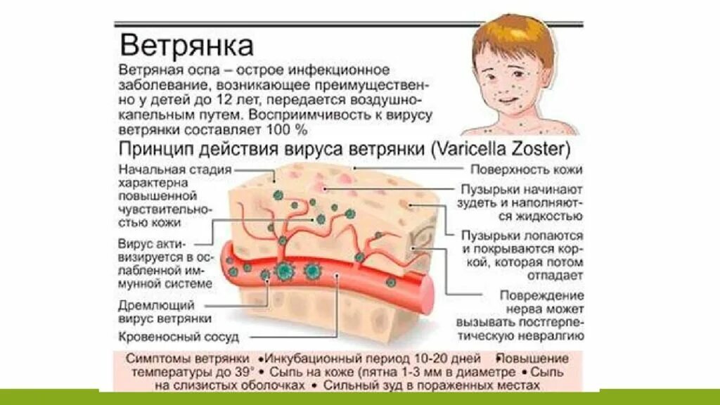 Ветрянка инкубационный период у взрослого сколько дней. Ветряная оспа у детей периоды. Ветрянка клиника инкубационный период. Ветрянка у детей симптомы. Ветряная оспа инкубационный период у детей.