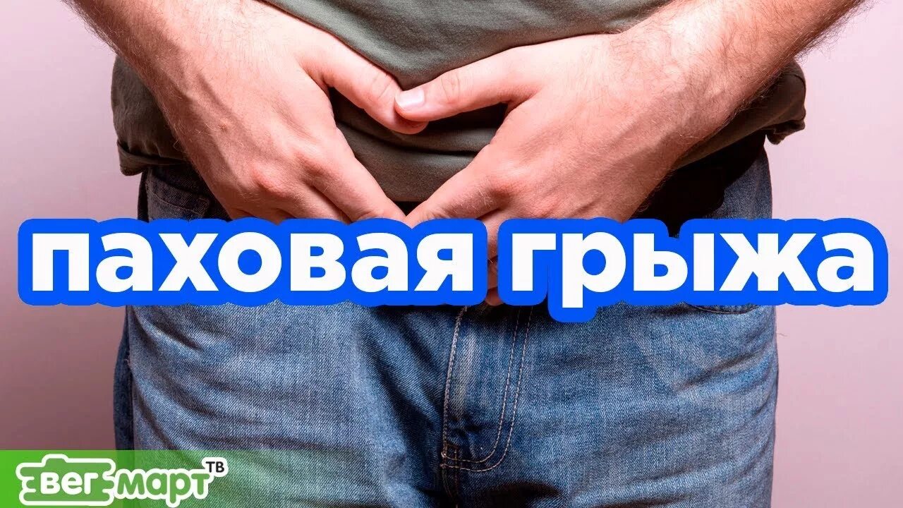 Как лечить паховую грыжу у мужчин. Паховая грыжа рекомендации. паховая грыжа у мужчин лечение. лечение паховой грыжи у мужчин народными средствами. мошенники паховая грыжа у мужчин.