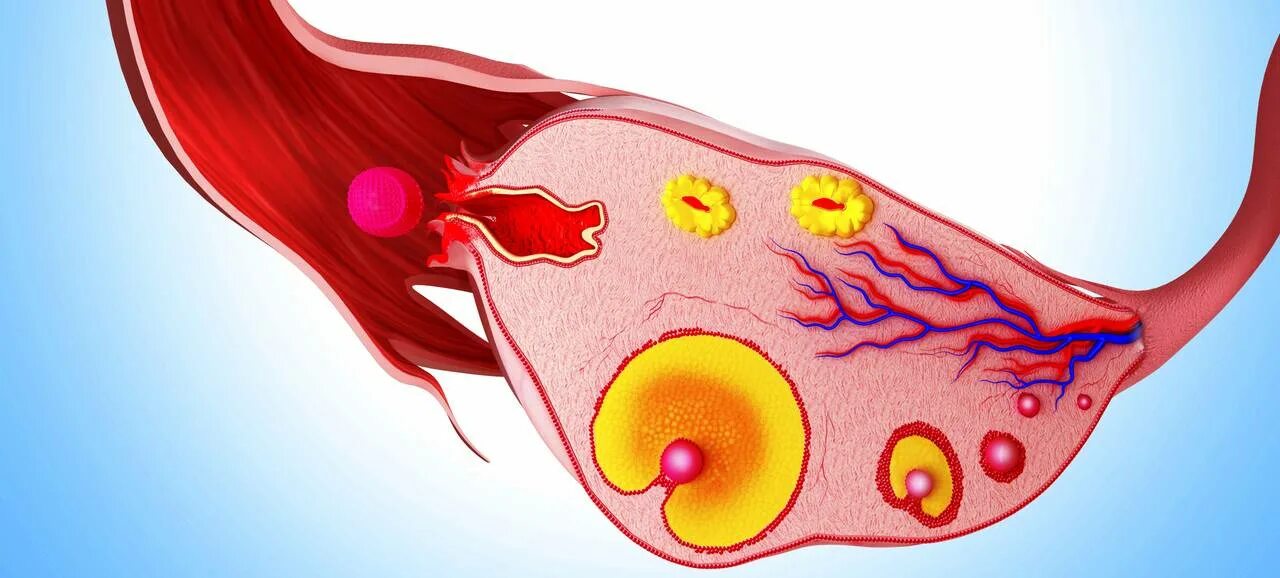 Что образуется в яичниках. Овариальный фолликул. Киста желтого тела яичника. В левом яичнике желтое тело 24мм что это. Овулировавший фолликул.